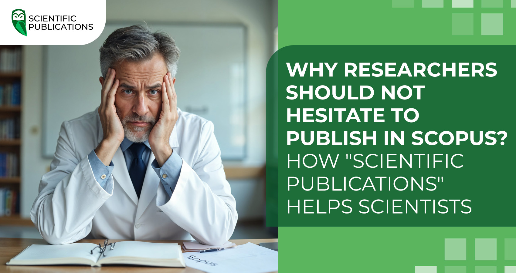 Why researchers should not hesitate to publish in Scopus? How 